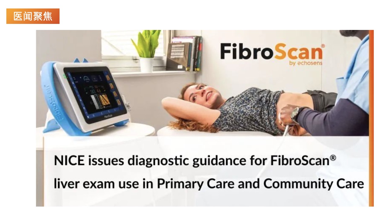 医闻聚焦 | NICE发布具有里程碑意义的指导意见，将常规肝脏扫描引入初级保健机构