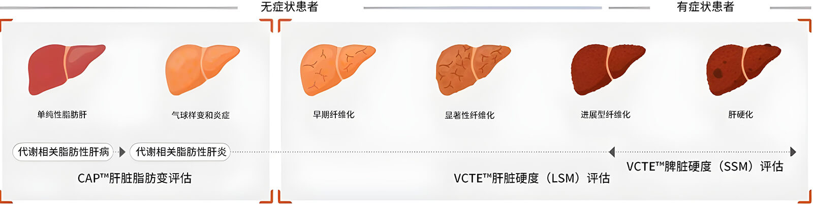 FibroScan?两大核心技术